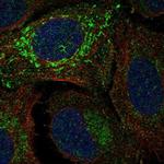 NDUFV2 Polyclonal Antibody