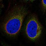 CNEP1R1 Polyclonal Antibody