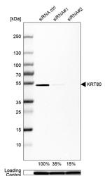 KRT80 Antibody in Western Blot (WB)