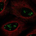 SMKR1 Polyclonal Antibody