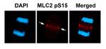 Phospho-MYL2 (Ser15) Antibody in Immunocytochemistry (ICC/IF)