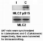 Phospho-MYL2 (Ser15) Antibody in Western Blot (WB)