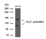 Phospho-DLC1 (Ser986) Antibody in Western Blot (WB)