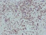 Phospho-beta Catenin (Ser715) Polyclonal Antibody