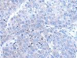 BTG4 Polyclonal Antibody