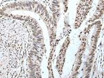 POT1 Polyclonal Antibody