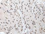 POT1 Antibody in Immunohistochemistry (Paraffin) (IHC (P))