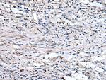 QSOX1 Polyclonal Antibody