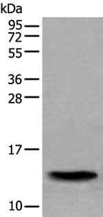 SAA4 Antibody in Western Blot (WB)