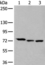 SLC27A4 Antibody in Western Blot (WB)