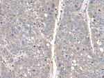 THAP10 Polyclonal Antibody