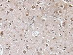 TRIM27 Polyclonal Antibody