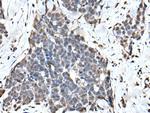 ATF6-beta Polyclonal Antibody