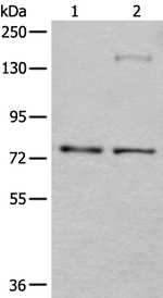 ATF6-beta Antibody in Western Blot (WB)