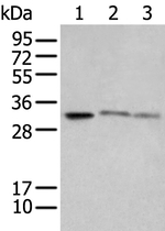 SPIC Antibody in Western Blot (WB)