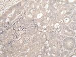 ZNF138 Polyclonal Antibody