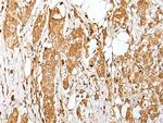 ZMAT2 Polyclonal Antibody