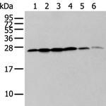 ZMAT2 Antibody in Western Blot (WB)