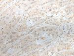 ZNF238 Polyclonal Antibody