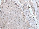 YPEL2 Polyclonal Antibody