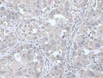 UBE2Q2 Antibody in Immunohistochemistry (Paraffin) (IHC (P))