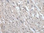 UBE2W Polyclonal Antibody