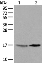 UBE2W Antibody in Western Blot (WB)