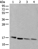 UBE2D3 Antibody in Western Blot (WB)