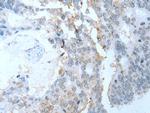 SYCP2 Polyclonal Antibody