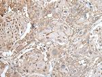 Claudin 6 Antibody in Immunohistochemistry (Paraffin) (IHC (P))