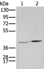 HOXA2 Antibody in Western Blot (WB)