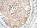 HOXD3 Antibody in Immunohistochemistry (Paraffin) (IHC (P))
