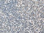 HRASLS3 Antibody in Immunohistochemistry (Paraffin) (IHC (P))