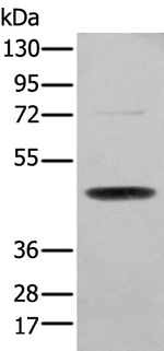SERPINH1 Antibody in Western Blot (WB)