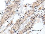 PROK1 Polyclonal Antibody