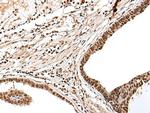 PTOV1 Antibody in Immunohistochemistry (Paraffin) (IHC (P))