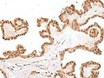 PTOV1 Polyclonal Antibody