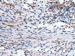 EMP1 Polyclonal Antibody