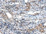 CXCL6 Polyclonal Antibody