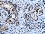 HOXD10 Antibody in Immunohistochemistry (Paraffin) (IHC (P))