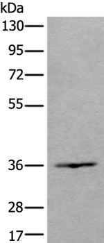 HOXD10 Antibody in Western Blot (WB)