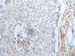 MAGEB5 Polyclonal Antibody