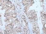 MTHFR Polyclonal Antibody