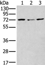 MTHFR Antibody in Western Blot (WB)