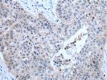 ZDHHC5 Polyclonal Antibody