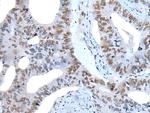 ZNF76 Polyclonal Antibody