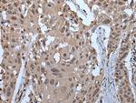 ZNF787 Antibody in Immunohistochemistry (Paraffin) (IHC (P))