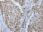 ZNHIT3 Polyclonal Antibody