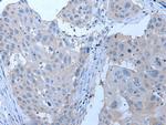 YPEL4 Polyclonal Antibody