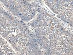 XDH Polyclonal Antibody
